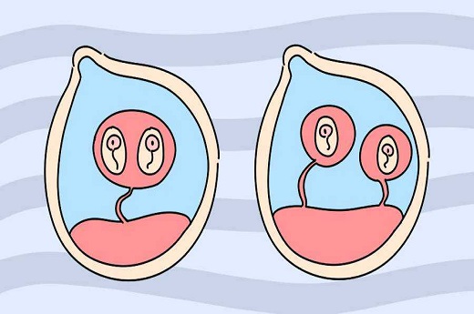 试管婴儿早期怎么保胎？