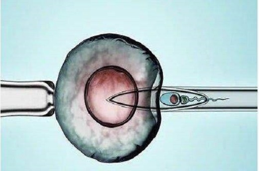 试管婴儿胚胎质量怎么知道？-宝宝灯塔网